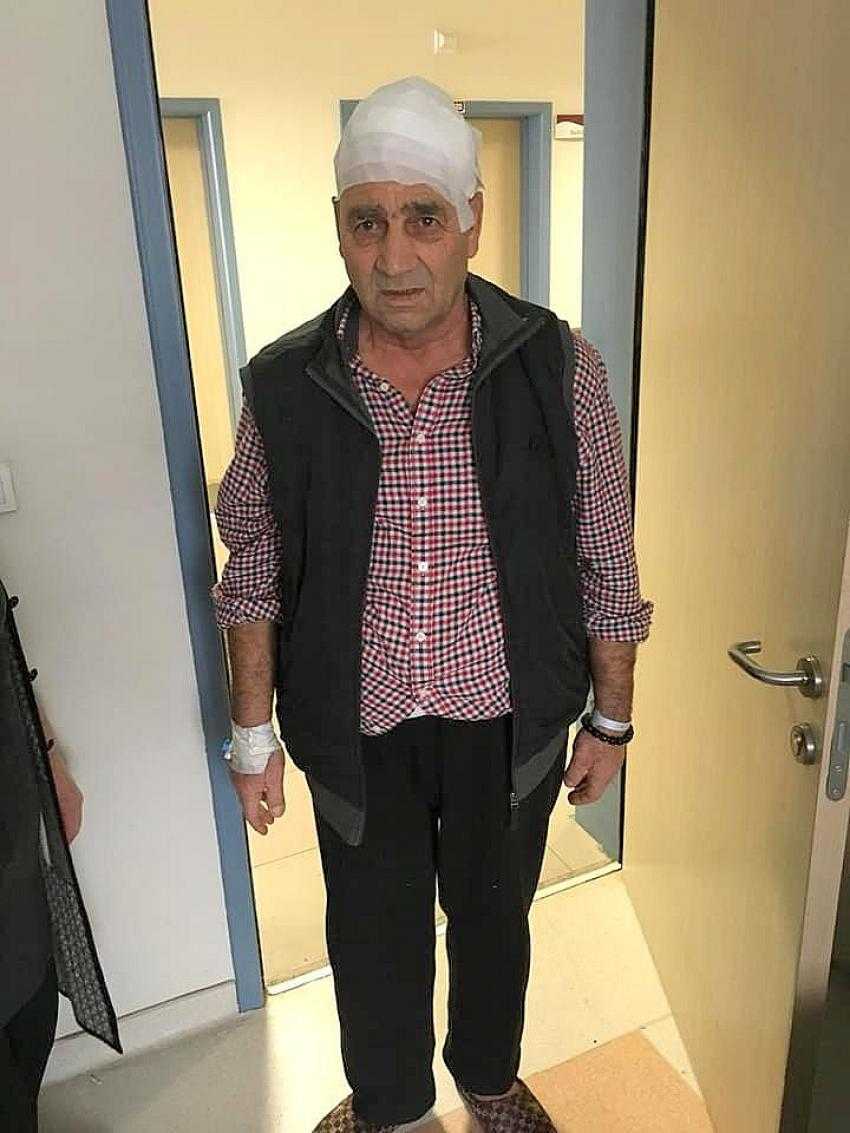 Iğdır'da ilk defa kötü beyin tümörü ameliyatı başarıyla yapıldı.