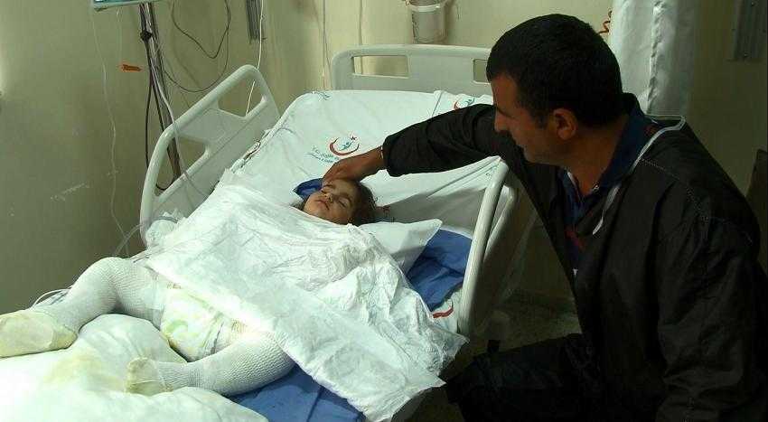 Oyun Oynayan Çocuk Tandıra Düşerek...