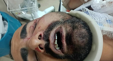 Devlet Varken Kimse Kendi Adaletini Uygulayamaz!